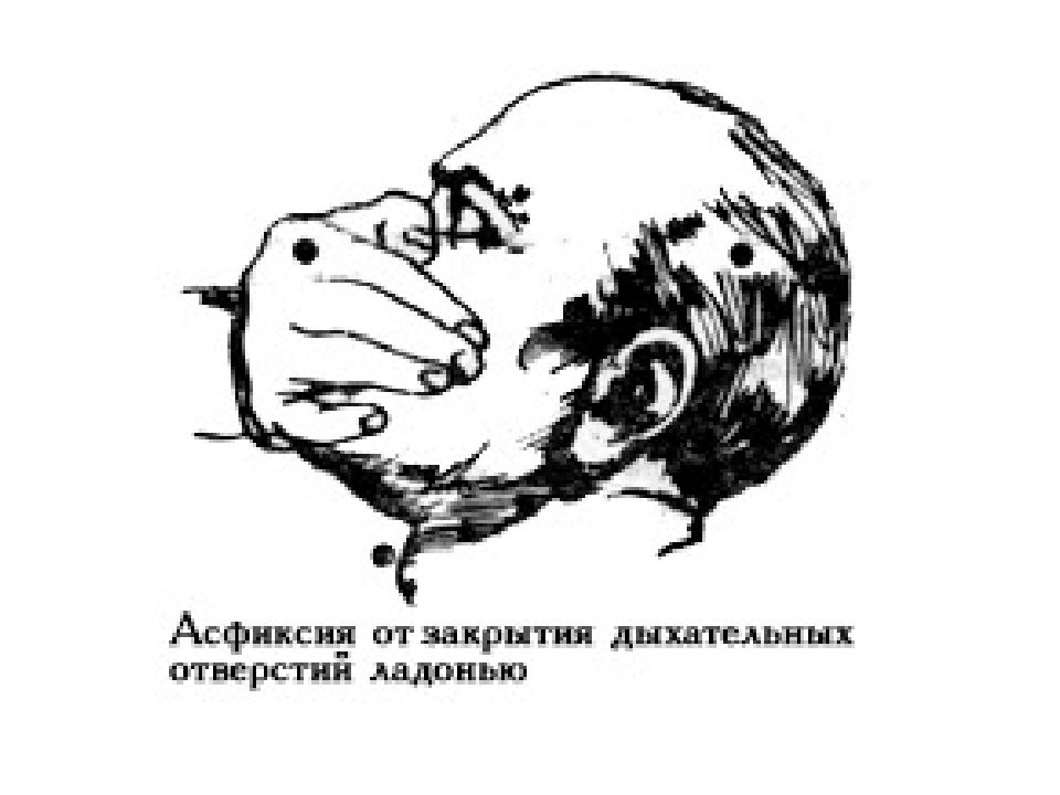 Механическая асфиксия презентация