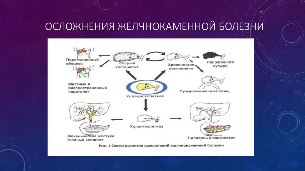 Острый и хронический холецистит презентация