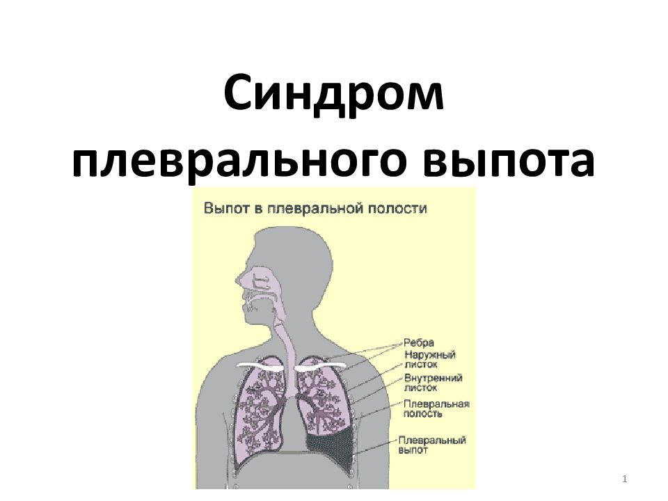 Плевральный выпот презентация