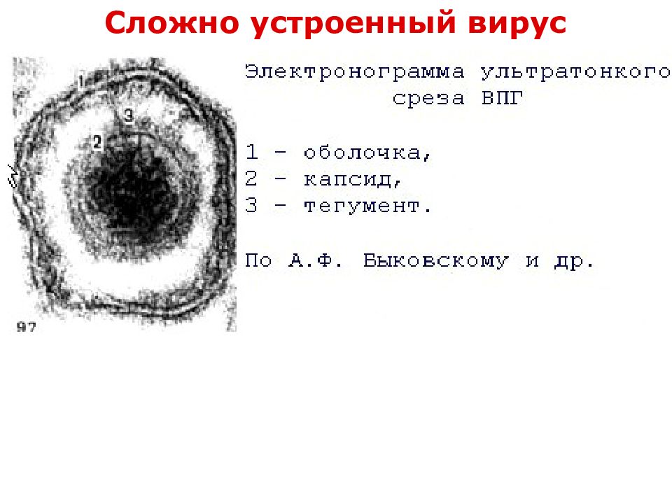 Сложно устроенный. Сложно устроенный вирус. Микротрихии. Сложно устроенного вируса. Цитология 1 курс.