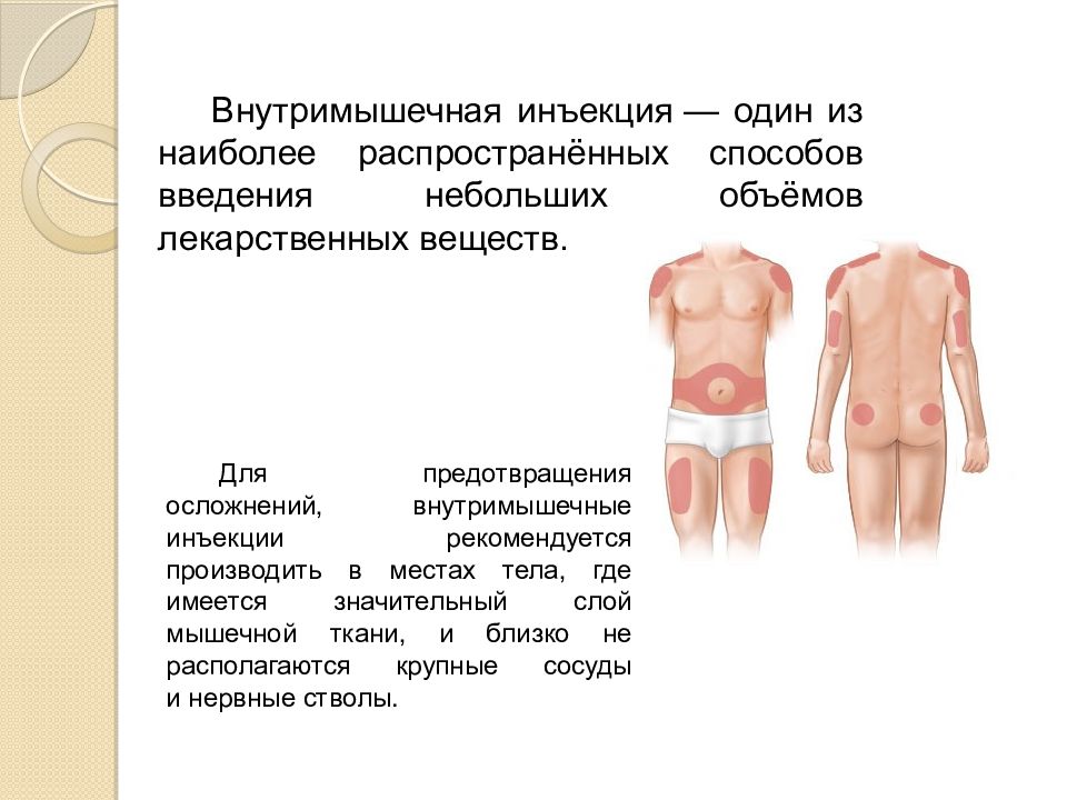 Место введения. Внутримышечной инъекции место введения инъекций. Местом выполнения внутримышечной инъекции являются. Внутримышечный Введение лекарственных средств место инъекции. Внутримышечное Введение анатомические области.