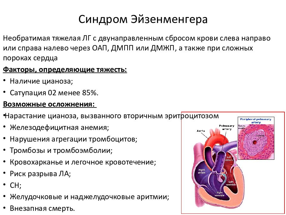 Презентация пороки сердца пропедевтика