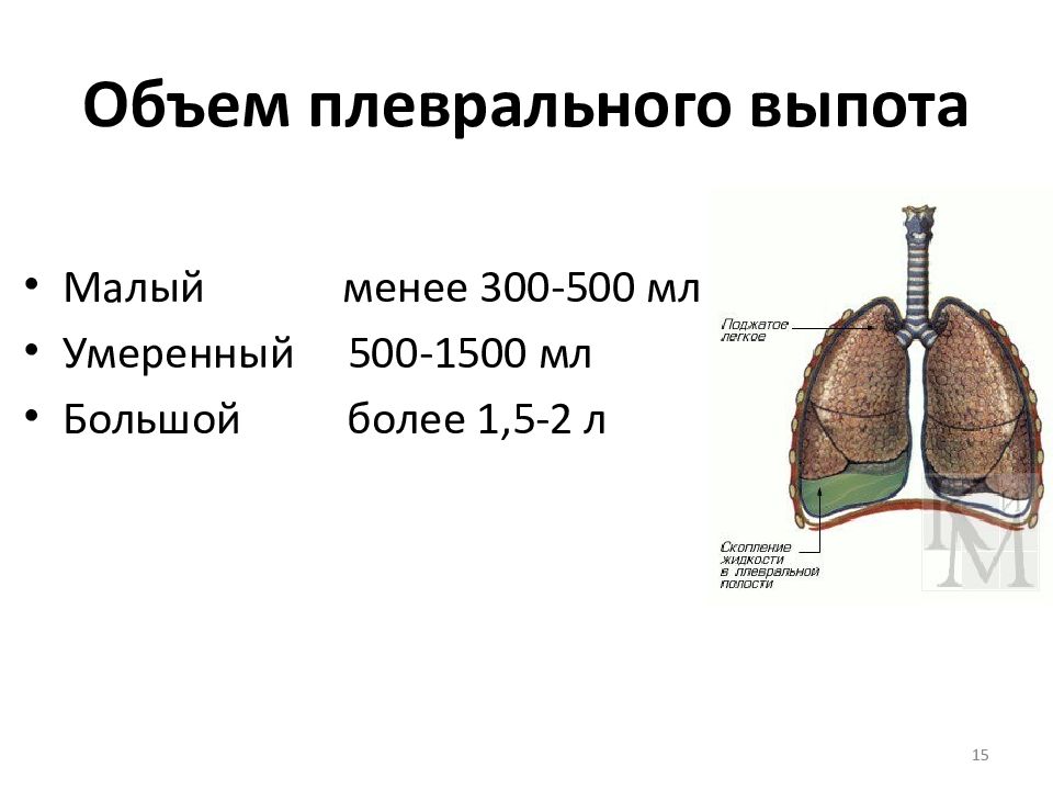 Плевральный выпот презентация