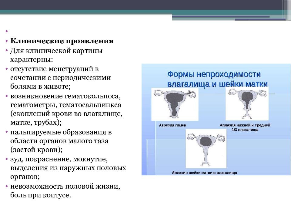 Развитие половых органов у девочек. Пороки развития половых органов. Аномальное развитие половых органов. Аномалии развития половых органов у мальчиков.