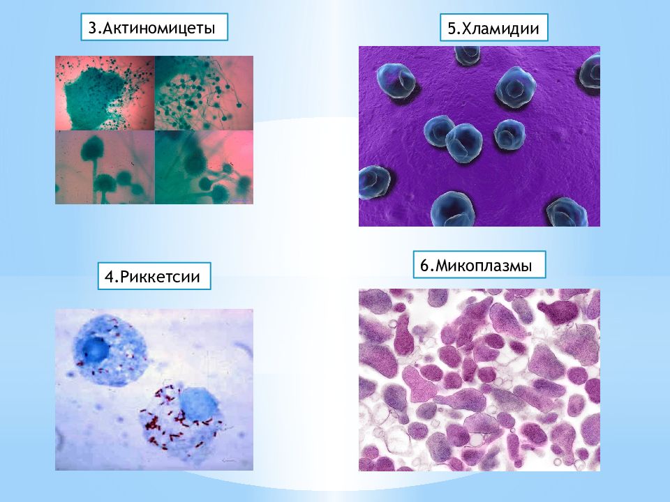 Хламидии и микоплазмы. Риккетсии хламидии микоплазмы. Риккетсий, хламидий, микоплазм.. Спирохеты риккетсии хламидии актиномицеты микоплазмы. Микоплазма хламидии микробиология.