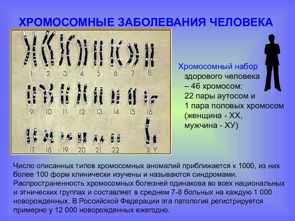 В зиготе человека содержится количество хромосом. Хромосомные болезни человека кариотип. Хромосомный набор человека. Хромосомы кариотип. Количество хромосом у человека.