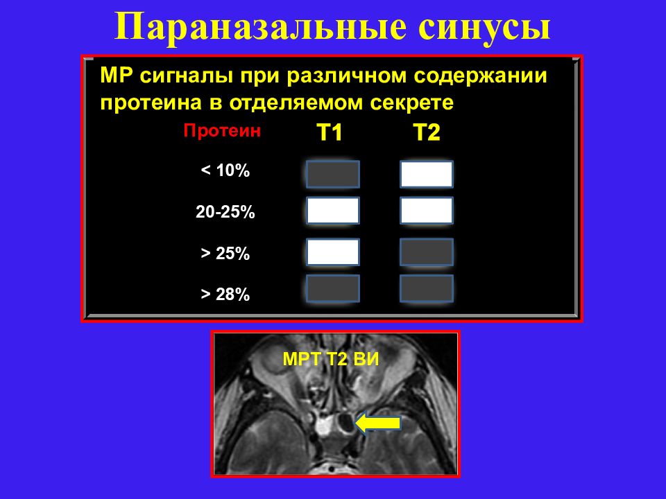 Лучевая диагностика заболеваний головы и шеи презентация