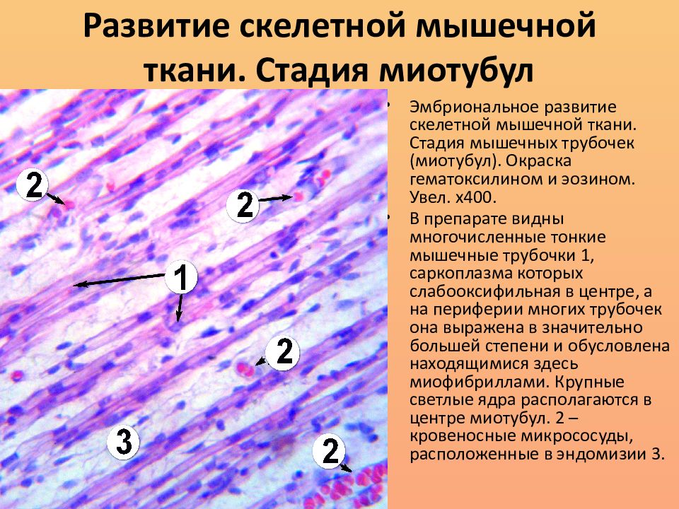 Мышечная ткань скелетных мышц. Скелетная мышечная ткань. Стадии развития скелетной мышечной ткани. Структурно-функциональная единица скелетной мышечной ткани. Скелетная мышечная ткань развивается из.