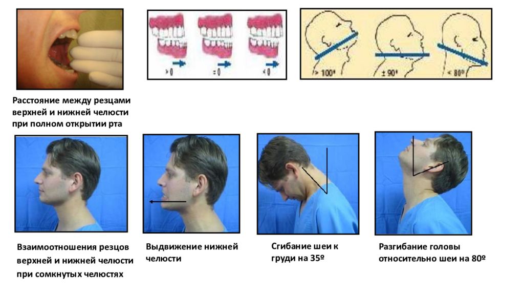 Почему не открывается рот