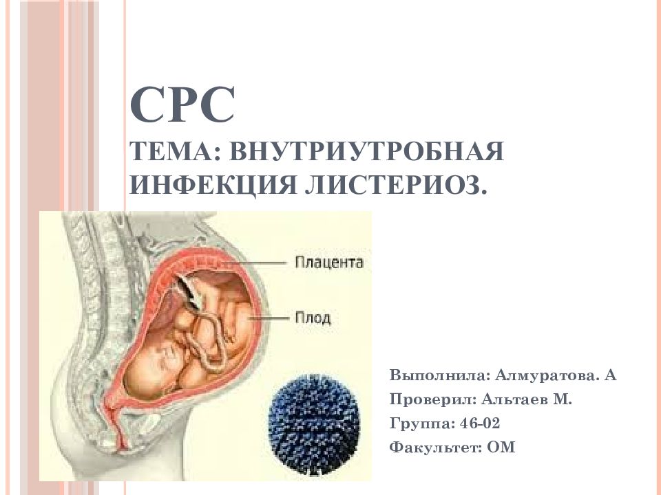 СРС Тема: Внутриутробная инфекция Листериоз.