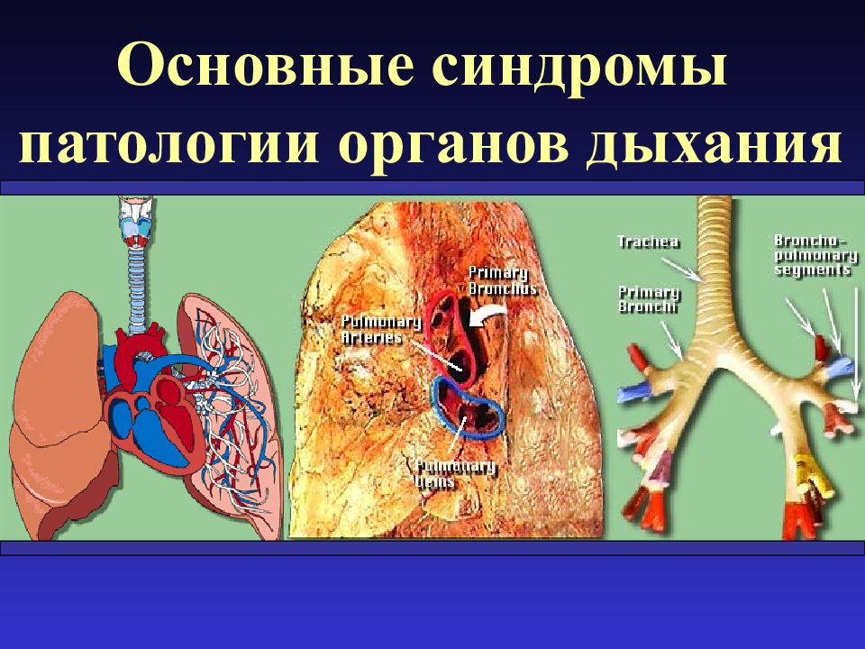 Основные синдромы патологии органов дыхания