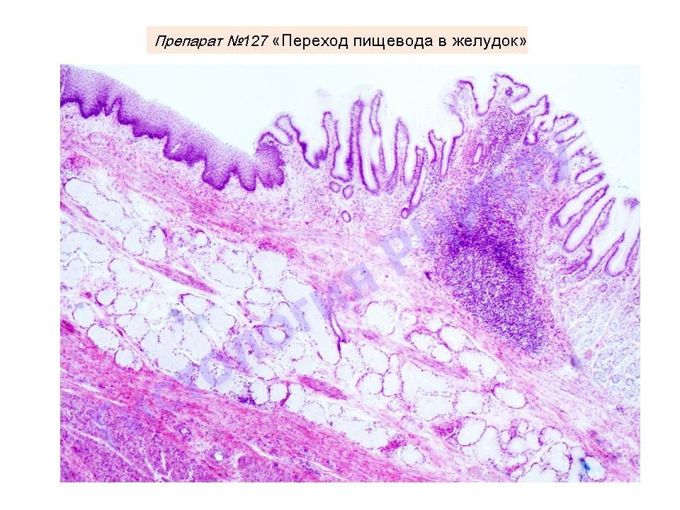 Гистология желудка. Пищеварительная система гистология препараты. Оболочка пищеварительная система гистология. Гистология пищеварительная система слизистая оболочка. Кардиальные железы пищевода гистология.