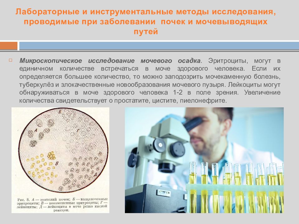 Инструментальные методы исследования мочевыделительной системы презентация