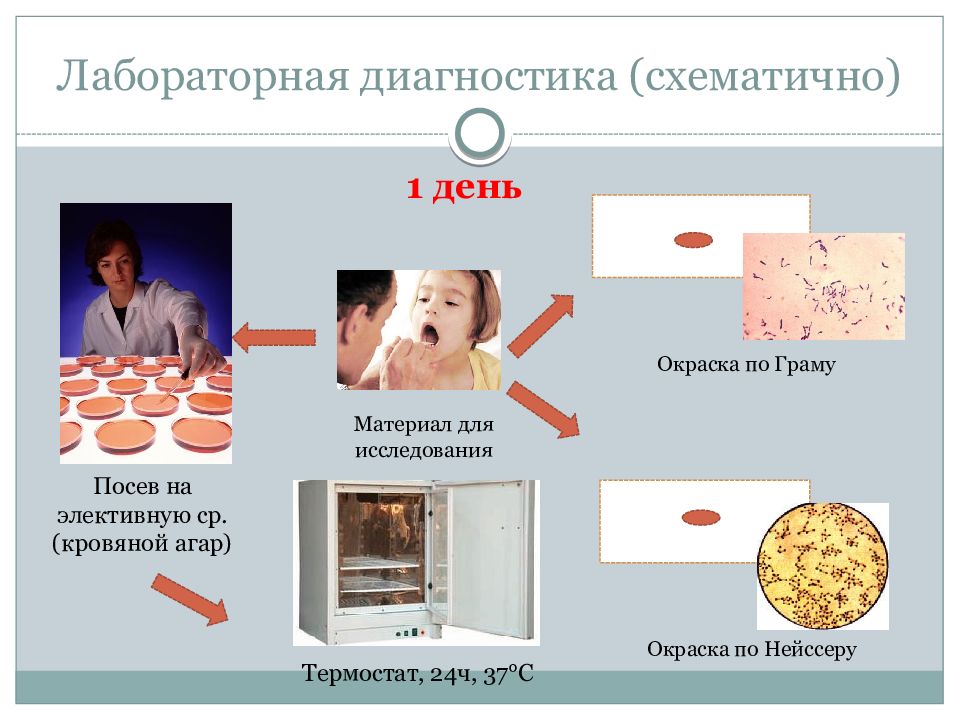 План обследования при дифтерии