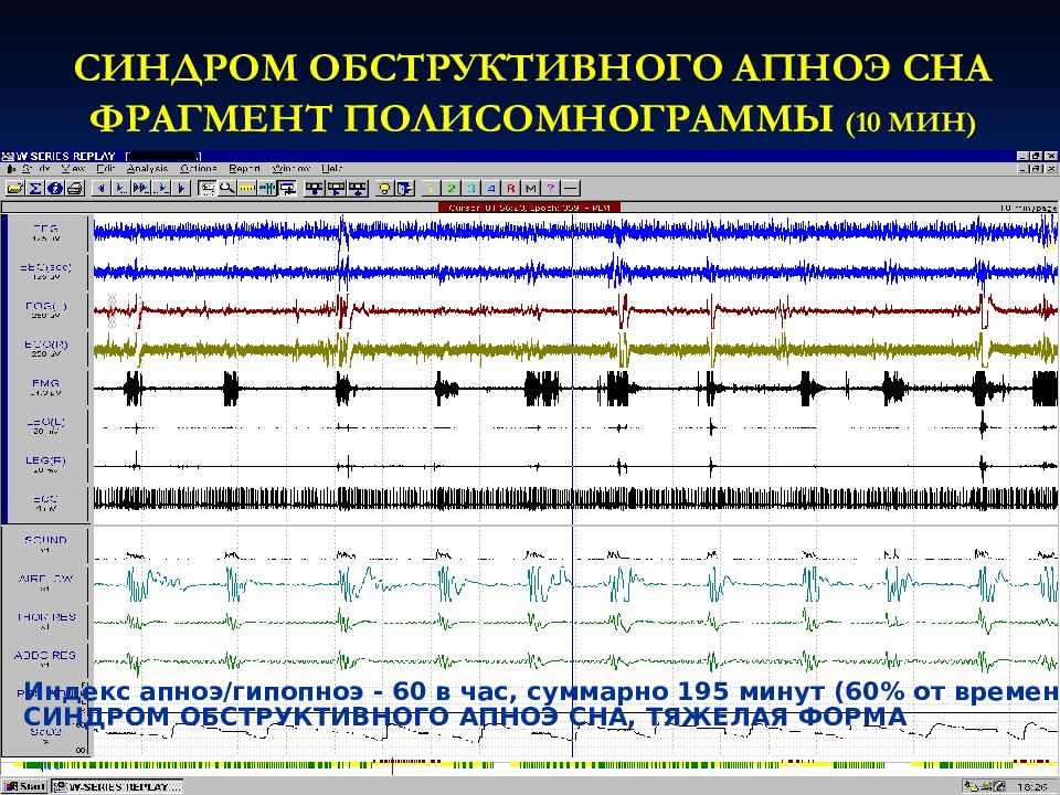 Схема истории болезни по факультетской терапии