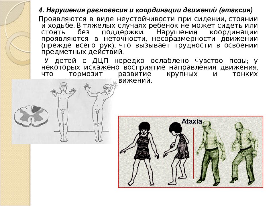 Нарушение движения. Нарушение равновесия и координации. Нарушение равновесия и координации движений это. Расстройство координации движений. Нарушения равновесия и координации при ДЦП – это:.