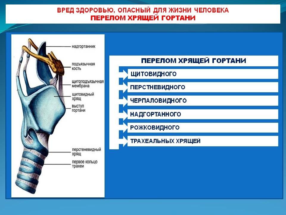 Риск вреда здоровью. Вред опасный для жизни человека. Вред опасный для жизни это. Вред не опасный для жизни и здоровья.