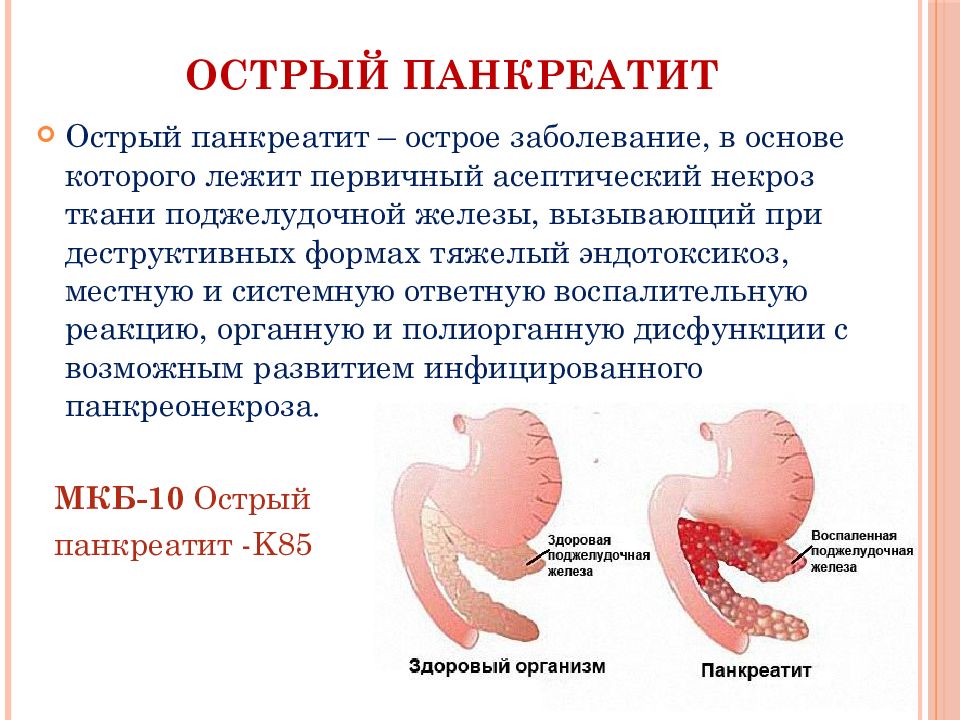 Презентация на тему острый панкреатит