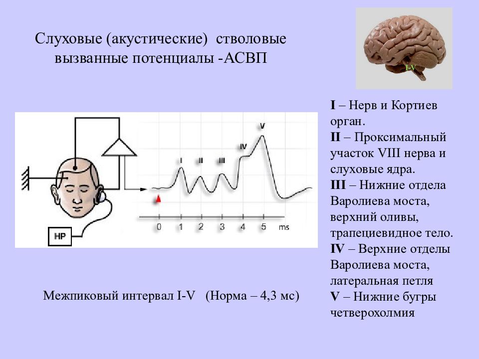 Вызови слух. Акустические стволовые вызванные потенциалы (АСВП). Слуховые вызванные потенциалы процедура. Длиннолатентные слуховые вызванные потенциалы норма. Слуховые вызванные потенциалы ствола головного мозга.