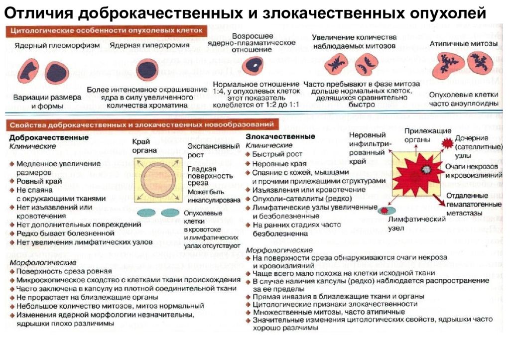 Картинки злокачественные и доброкачественные опухоли