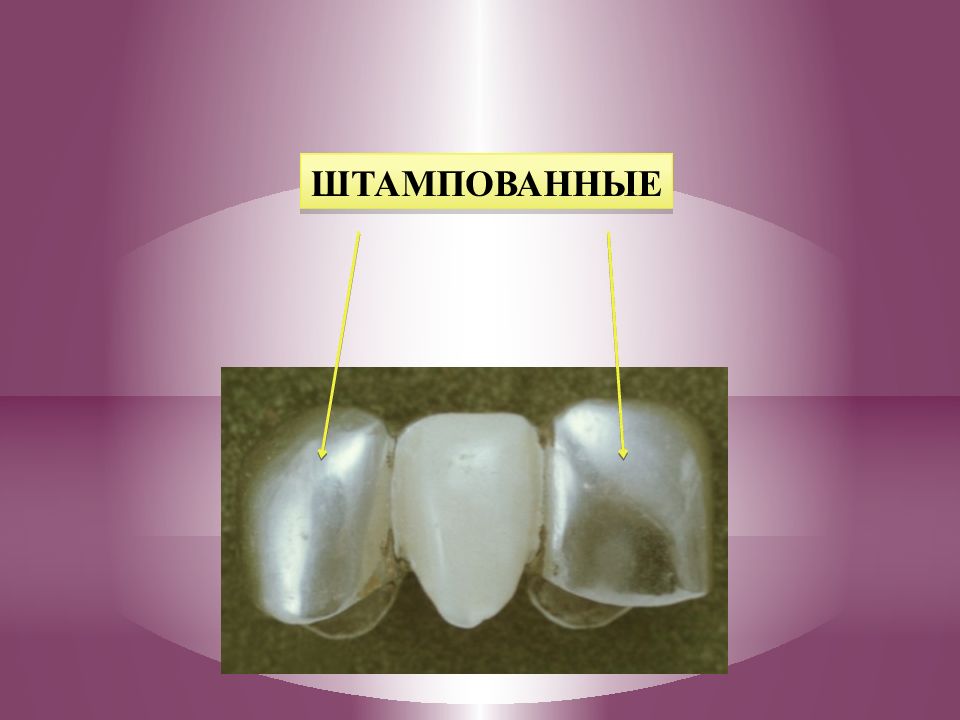 Презентация ортопедия коронки