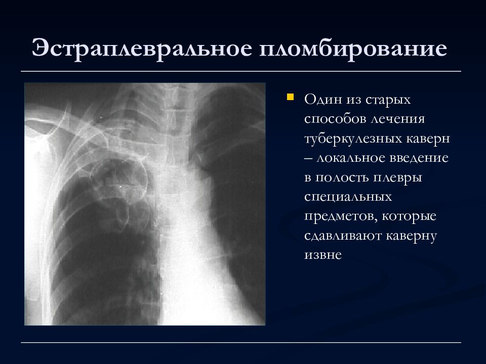 Лучевая диагностика органов дыхания презентация