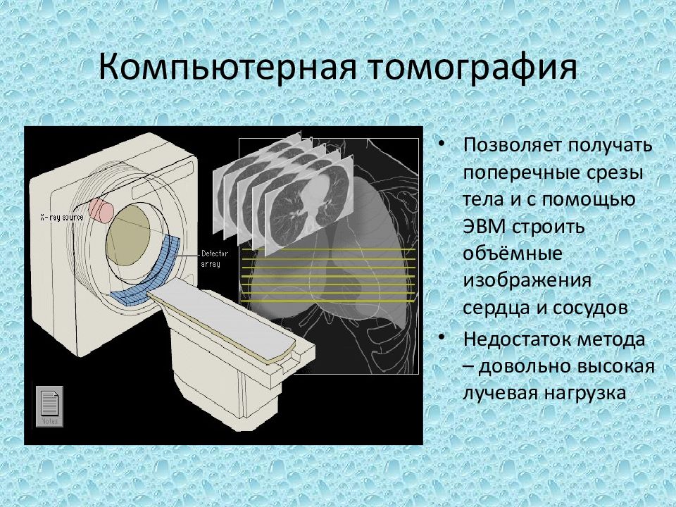 Технология позволяющая. Строение кт аппарата. Строение компьютерного томографа. Компьютерная томография принцип работы. Схема компьютерного томографа.