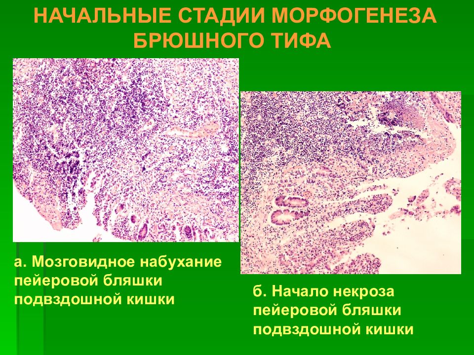 Патологическая анатомия презентации