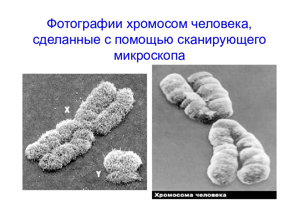 Хромосомы человека картинка