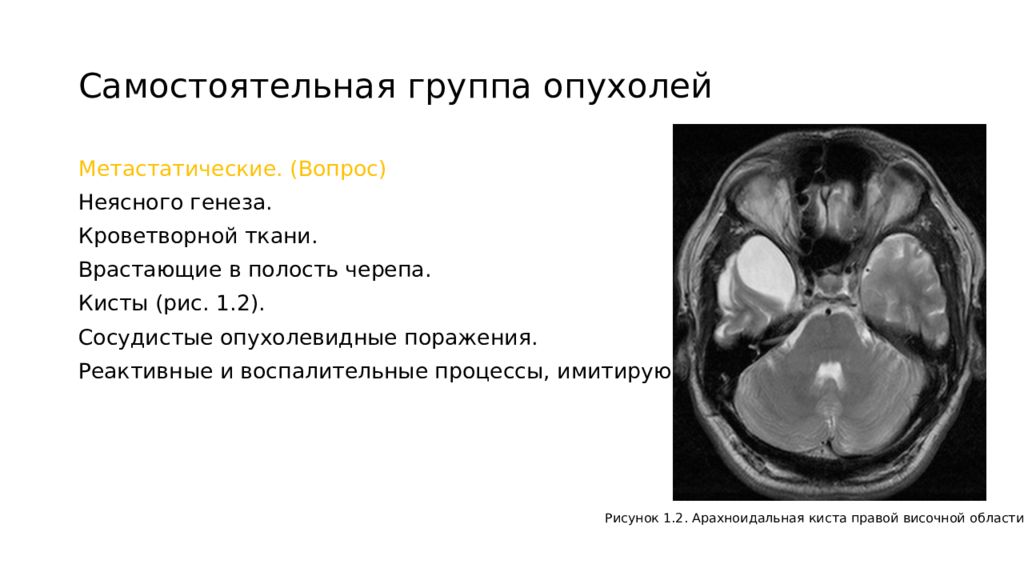 Самостоятельная группа. Опухоли врастающие в полость черепа. Опухоли врастающие в полость черепа презентация. Самостоятельная опухоль. Опухоли врастающие в полость черепа картинки.