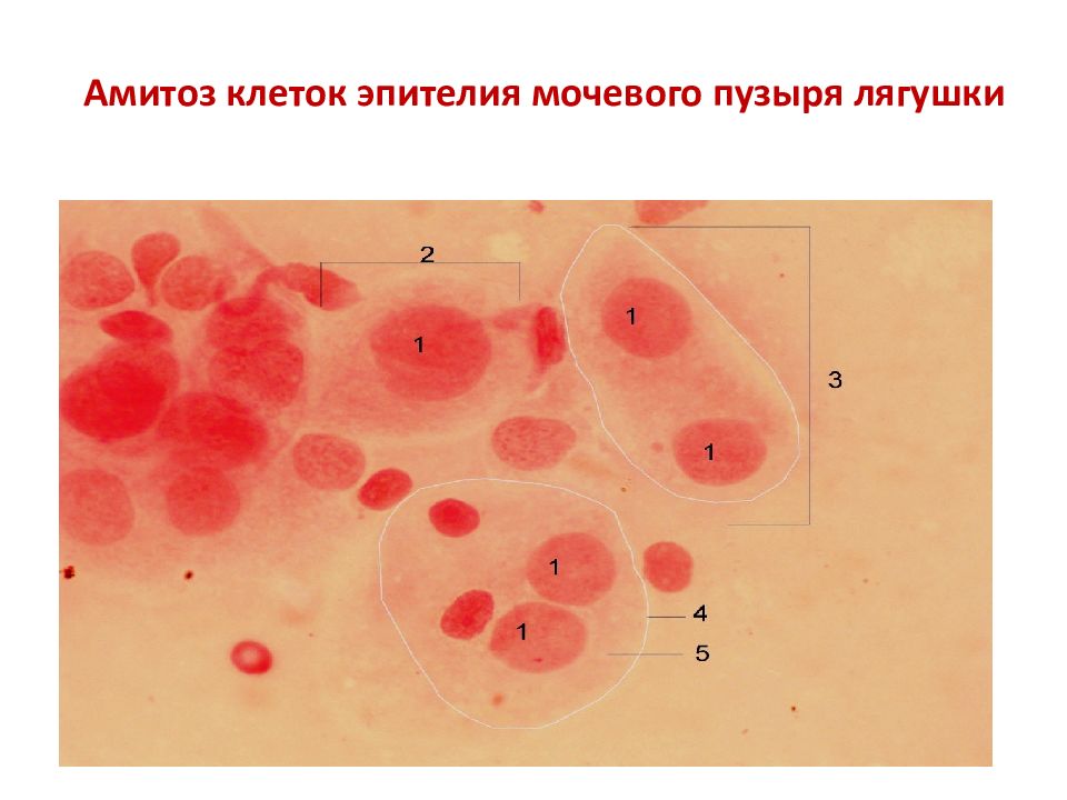 Эритроциты клетки цилиндрического эпителия. Амитоз в клетках эпителия мочевого пузыря. Амитоз в клетках мочевого пузыря мыши. Амитоз эпителиальных клеток мочевого пузыря. Амитоз. Клетки слизистой оболочки мочевого пузыря.