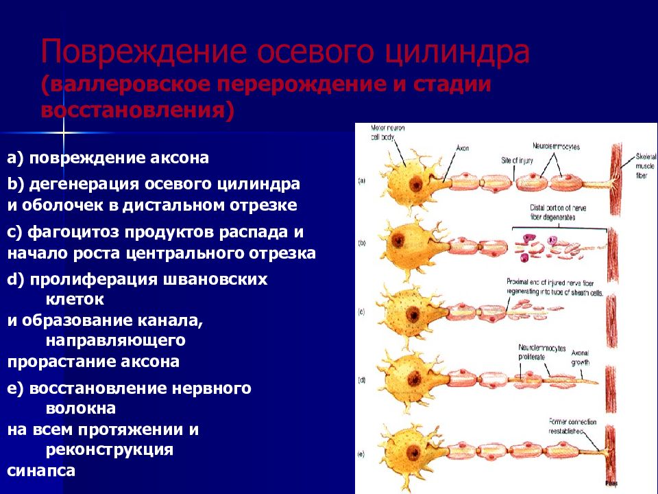 Регенерация нервной ткани презентация