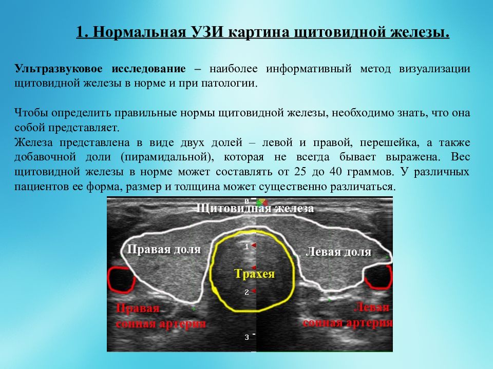 Щитовидная железа объем. Нормы исследования щитовидной железы УЗИ. УЗИ щитовидной железы показания нормы. Узищитовидноц железы норма. Измерение объема щитовидной железы на УЗИ.