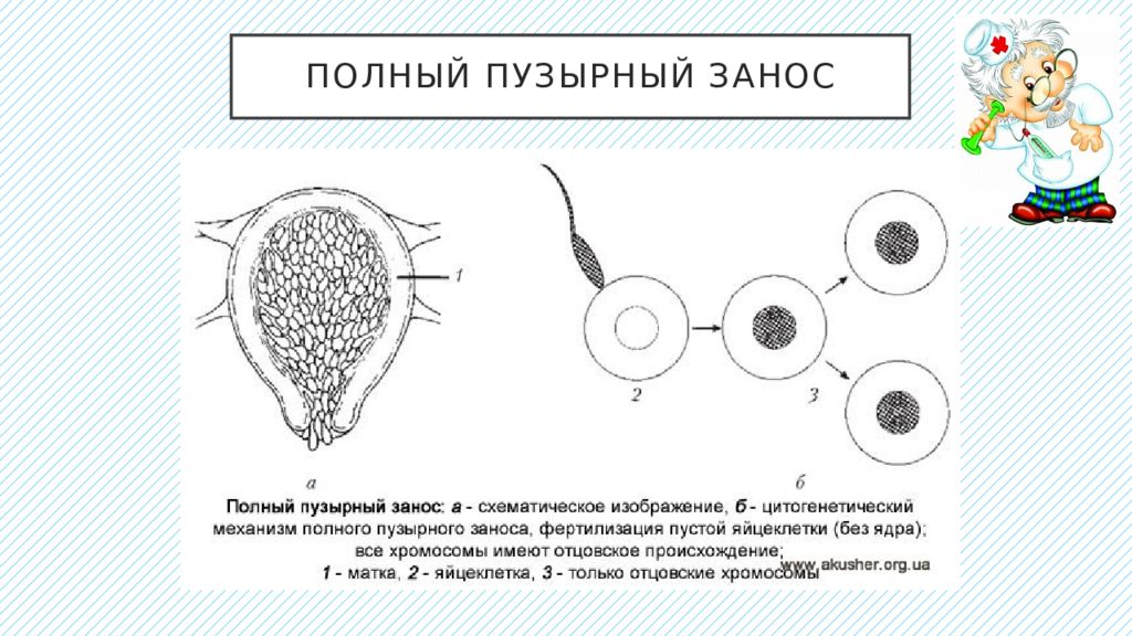 Пузырный занос презентация