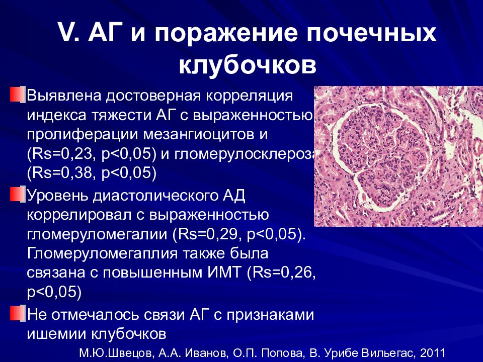 Поражение почек при системных заболеваниях презентация