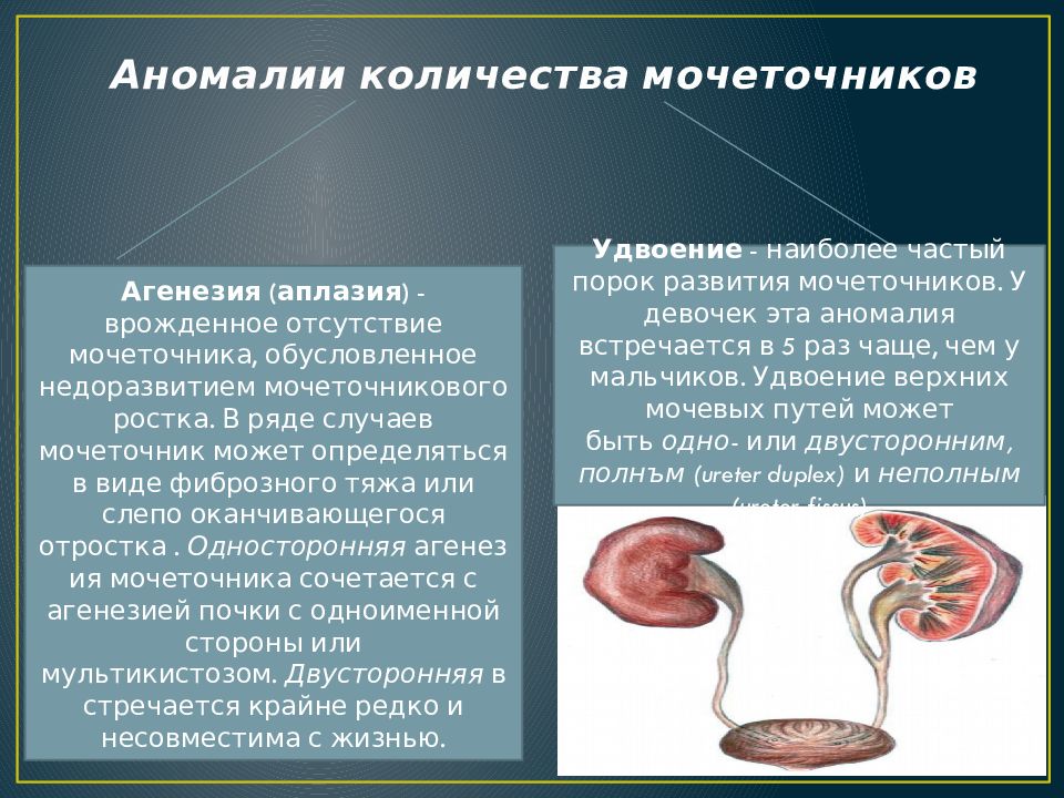 Аномалия развития почек презентация