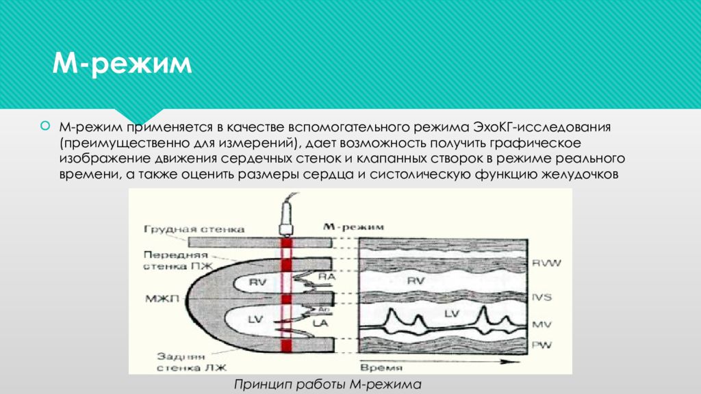 Режим исследования. М-режим ультразвукового исследования. А режим ультразвукового исследования. М режим УЗИ. Режимы исследования в УЗД.