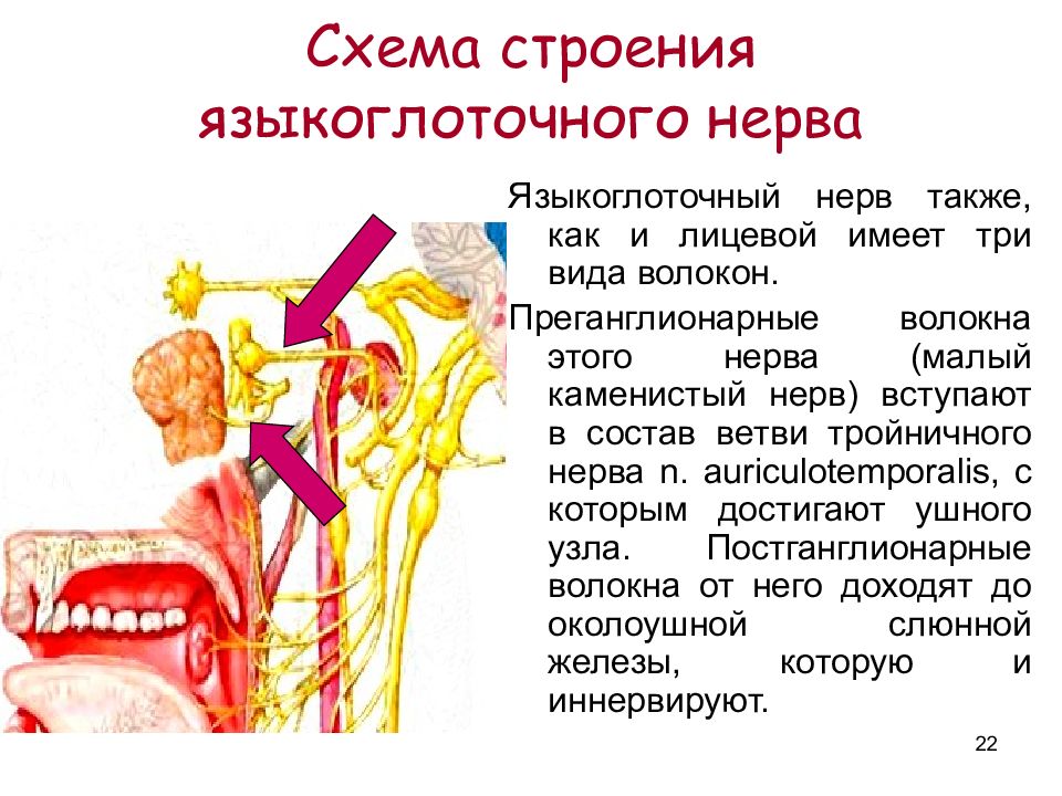 Невралгия языкоглоточного нерва презентация