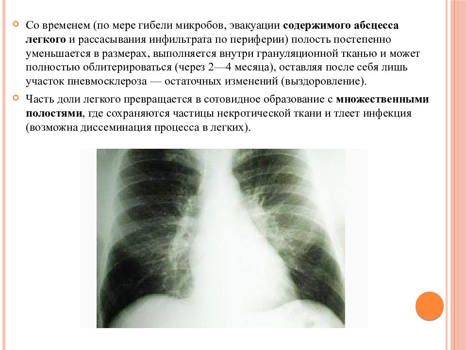 Лучевая диагностика органов дыхания презентация