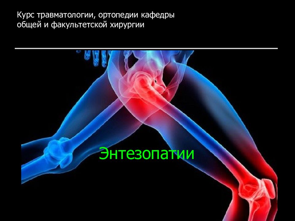 Энтезопатии Курс травматологии, ортопедии кафедры общей и факультетской хирургии