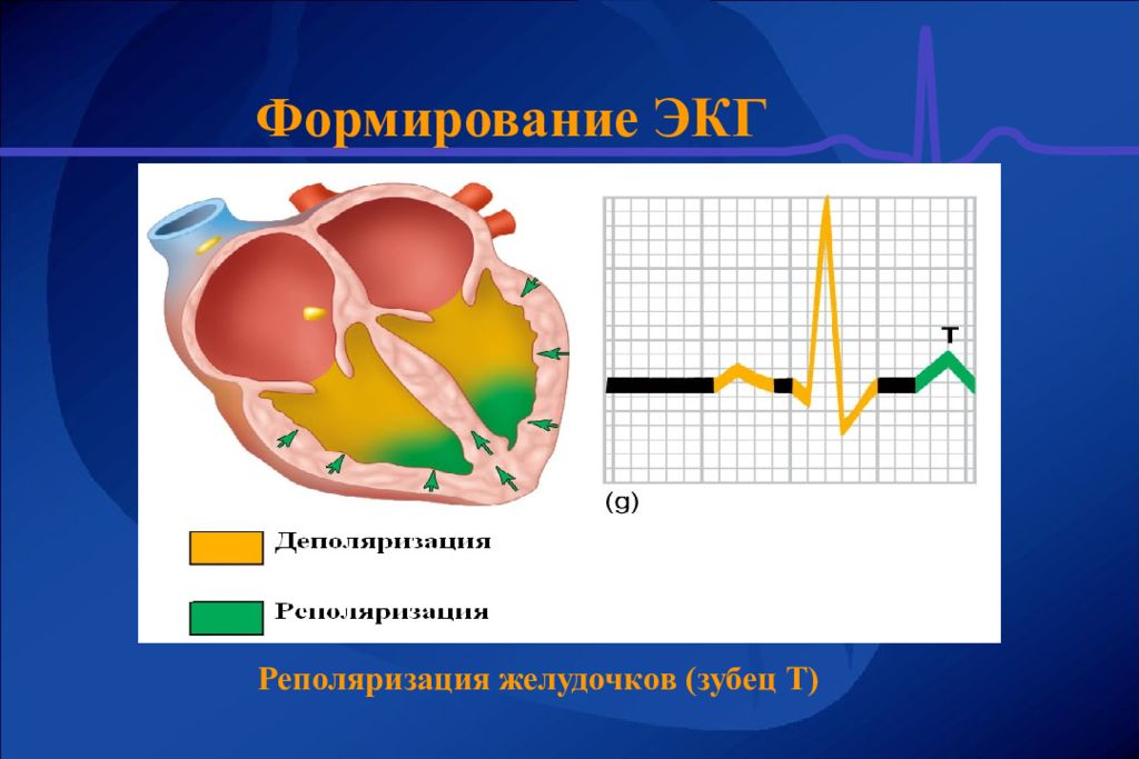 Синдром ранней желудочков. Формирование ЭКГ. Реполяризация это в ЭКГ. Деполяризация это в ЭКГ. Преждевременная деполяризация желудочков на ЭКГ.