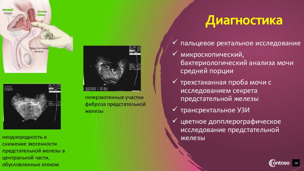 Ректальное исследование. Ректальное исследование предстательной железы. Пальцевое ректальное исследование. Пальцевое исследование предстательной железы. Пальцевое исследование предстательной железы алгоритм.