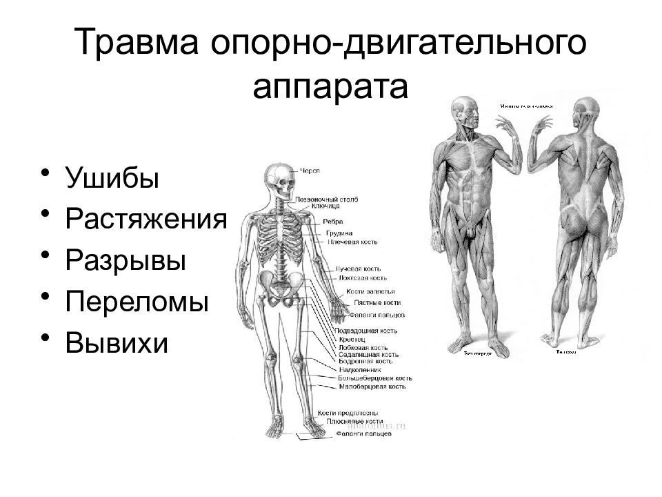 Реабилитация при травмах опорно двигательного аппарата презентация