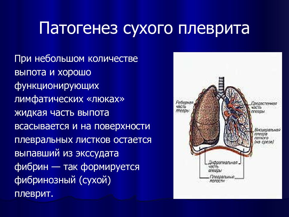 Плеврит легких без температуры