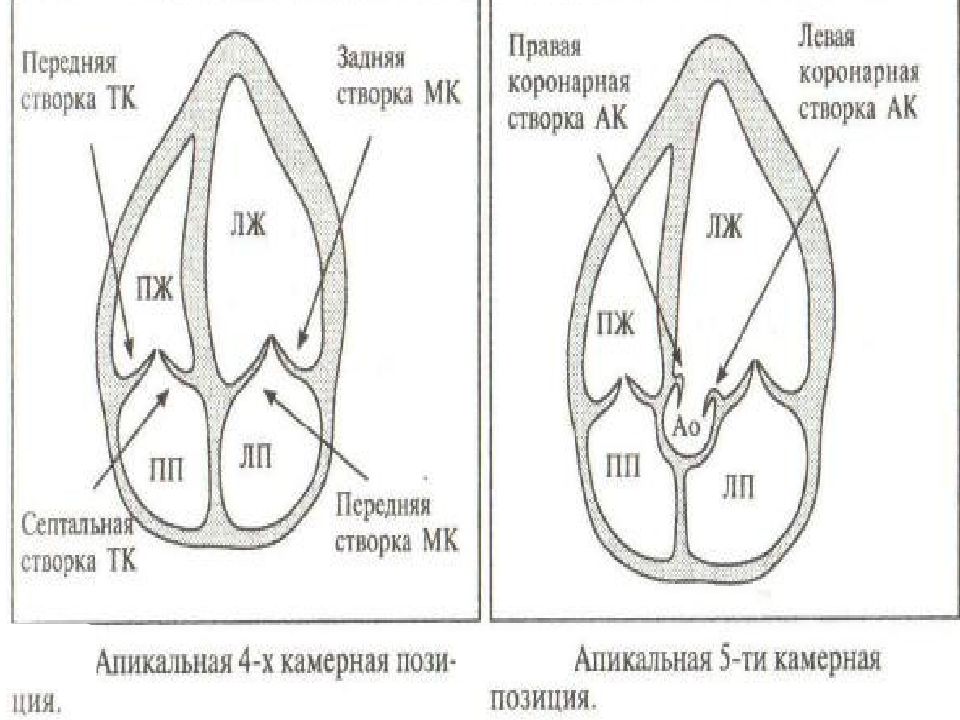 Узи сердца схема