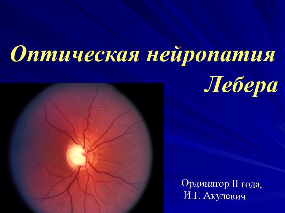 Оптическая нейропатия Лебера Ординатор II года, И.Г. Акулевич.