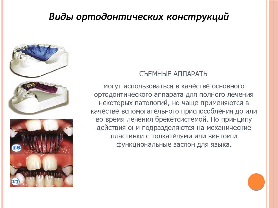 Ортодонтическое лечение детей презентация