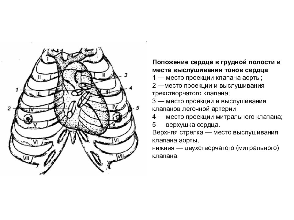 Клапаны сердца на грудной клетке. Проекция клапанов сердца на грудную клетку схема. Точки проекции и выслушивания клапанов сердца. Проекция границ сердца на грудную клетку. Проекции и точки аускультации клапанов сердца.