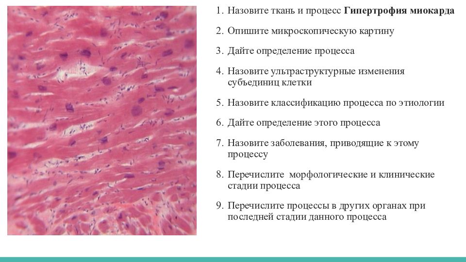 Гипертрофия миокарда. Гипертрофия кардиомиоцитов микропрепарат. Гипертрофия миокарда макропрепарат. Гипертрофия миокарда препарат. Гипертрофия миокарда микропрепарат.