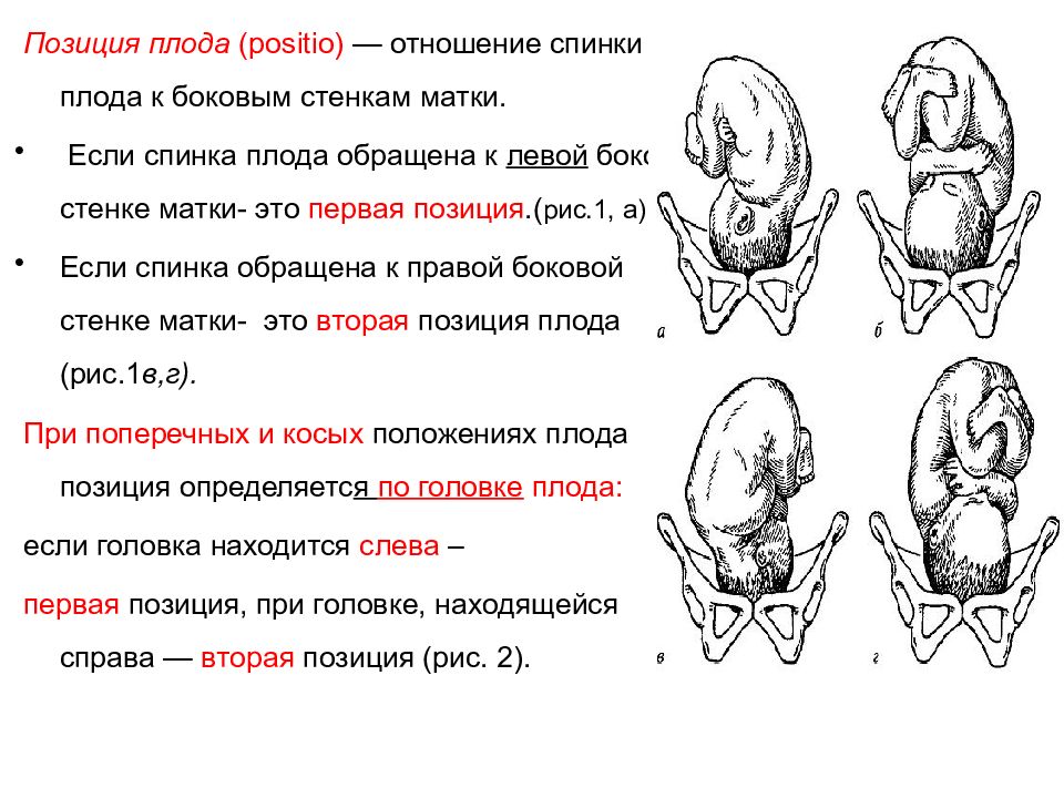 Положение плода картинки